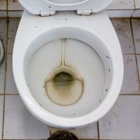 remove yellow toilet stains