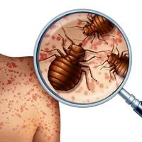 find bed bugs during the day time